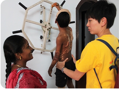 Capacity building for burn rehabilitation professionals in India