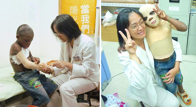 2010年，在外交部和萬芳醫院的努力之下，兩位來自聖多美和普林西比小朋友來臺就醫。陽光治療師協助製作壓力衣，讓他們有更完整的復健。